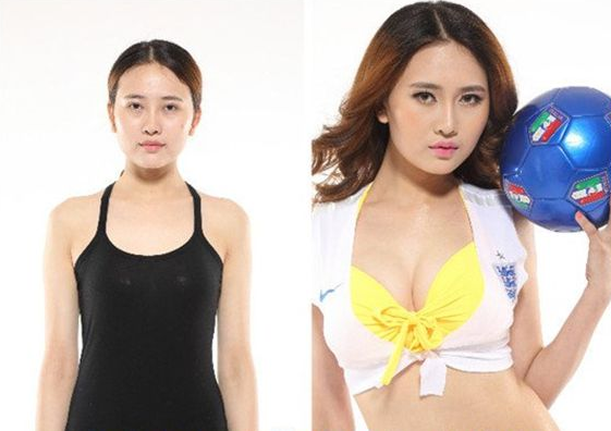 硅膠豐胸會有什么危害 硅膠豐胸會有什么危害